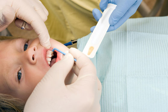 Dentist Applies Flouride on child's teeth