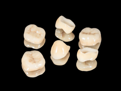 dental crowns