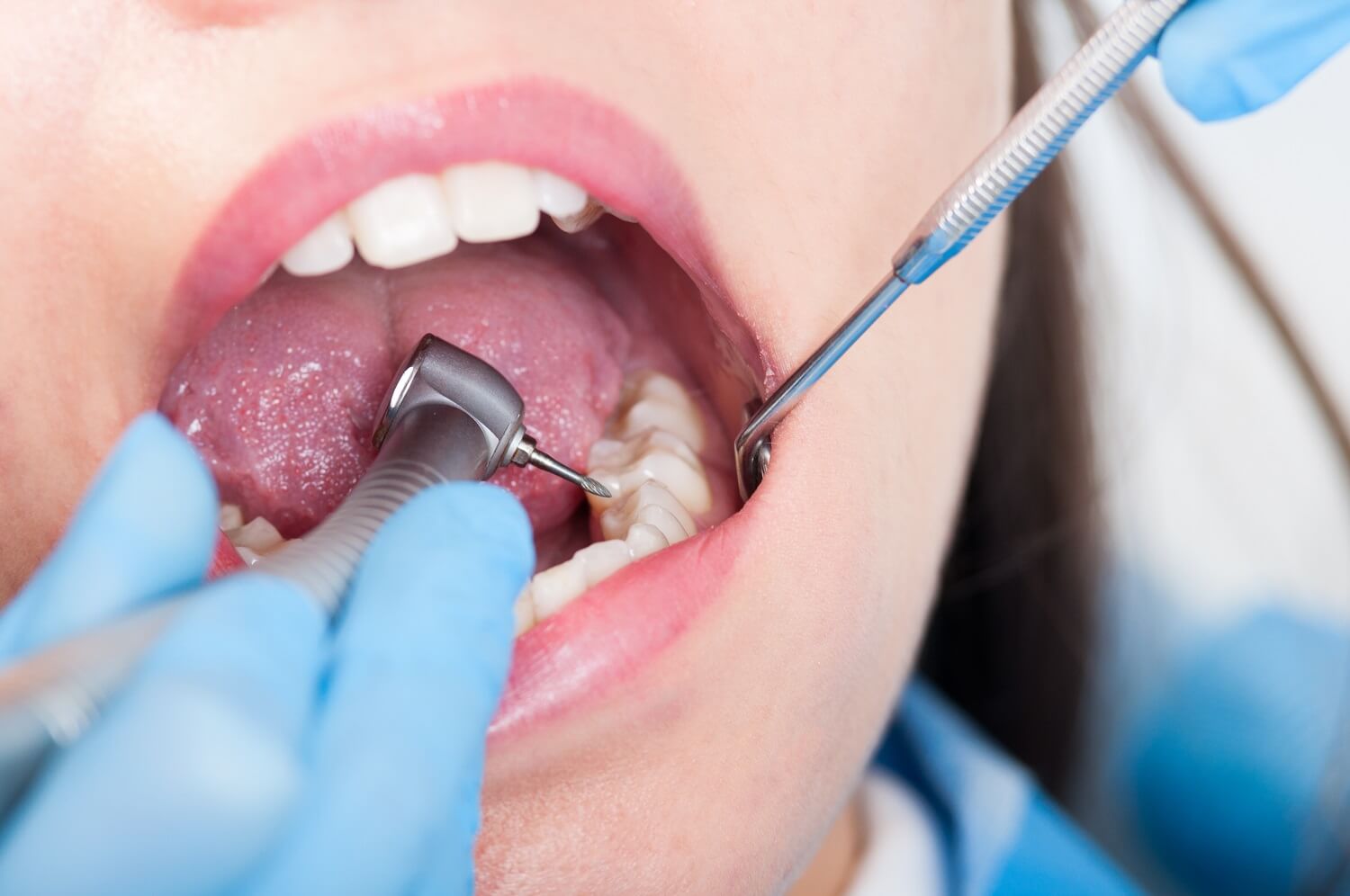 Dental Preston Treatment