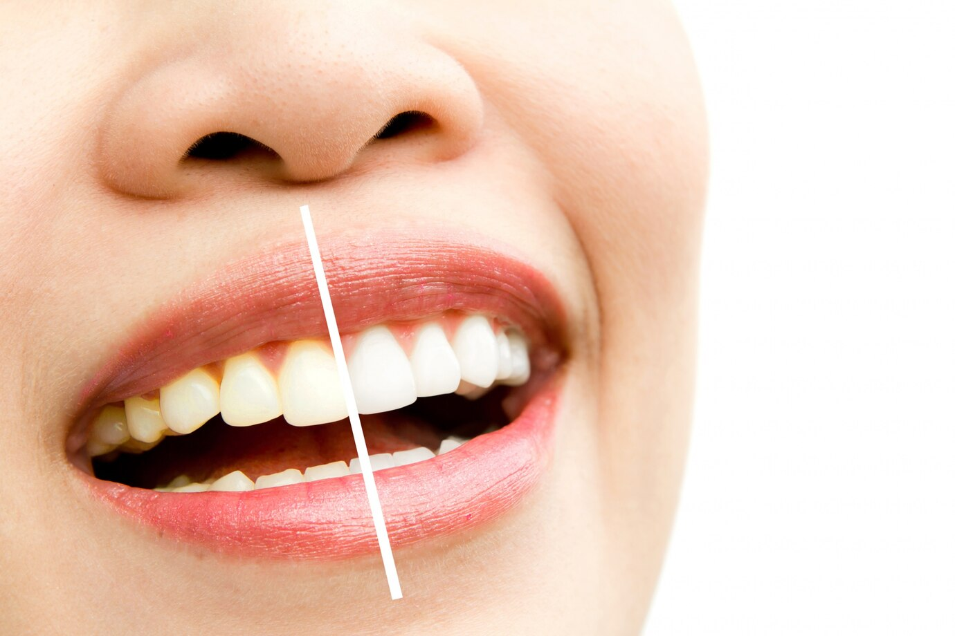 Cosmetic Dentistry Procedures
